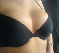 Se Opero Las Tetas Y Mira Como Quedaron (19)