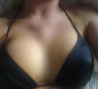Se Opero Las Tetas Y Mira Como Quedaron (5)