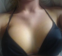 Se Opero Las Tetas Y Mira Como Quedaron (6)